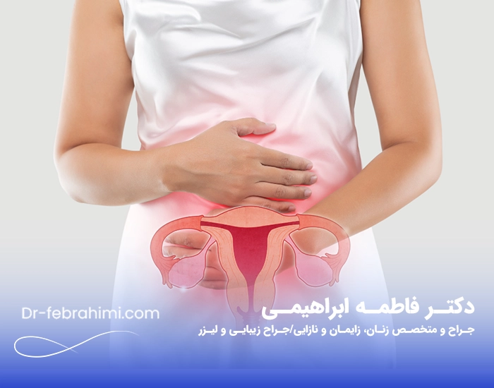 آندومتریوز، عکس آندومتریوز، دکتر آندومتریوز، دکتر زنان خوب آندومتریوز، دکتر زنان تهران