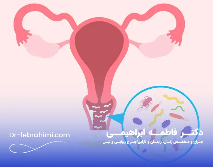 عفونت واژن، درمان عفونت واژن، علائم عفونت واژن در دختران، دکتر زنان در تهران
