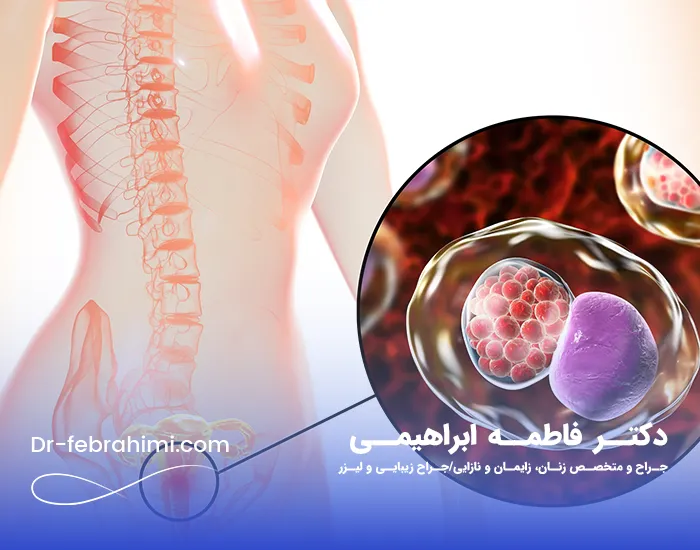 عفونت واژن، درمان عفونت واژن، علائم عفونت واژن در دختران، دکتر زنان در تهران